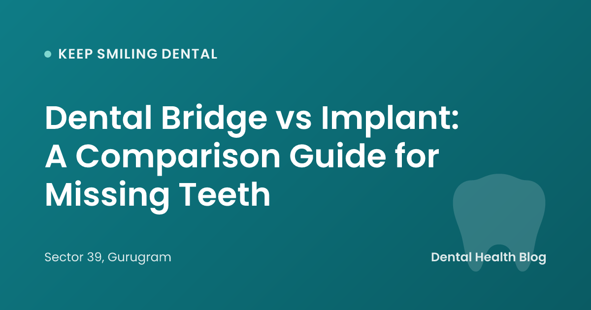 Dental Bridge vs Implant: A Comparison Guide for Missing Teeth
