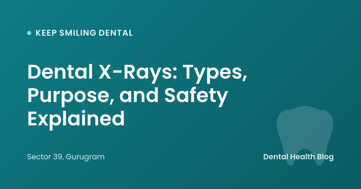Dental X-Rays: Types, Purpose, and Safety Explained