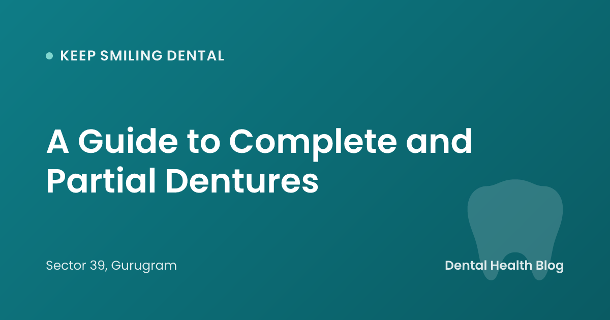A Guide to Complete and Partial Dentures