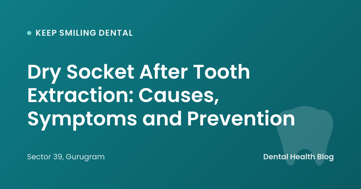 Dry Socket After Tooth Extraction: Causes, Symptoms and Prevention