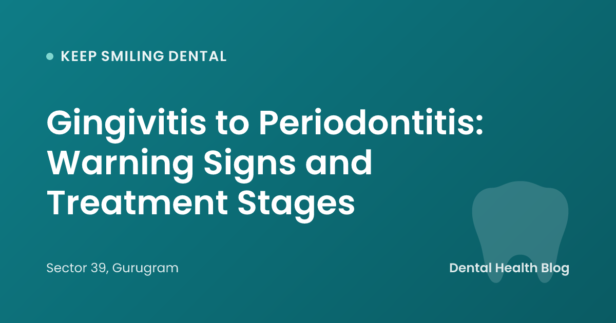 Gingivitis to Periodontitis: Warning Signs and Treatment Stages