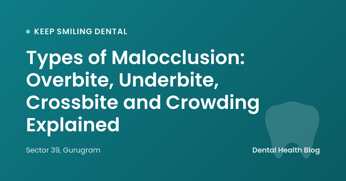 Types of Malocclusion: Overbite, Underbite, Crossbite and Crowding Explained