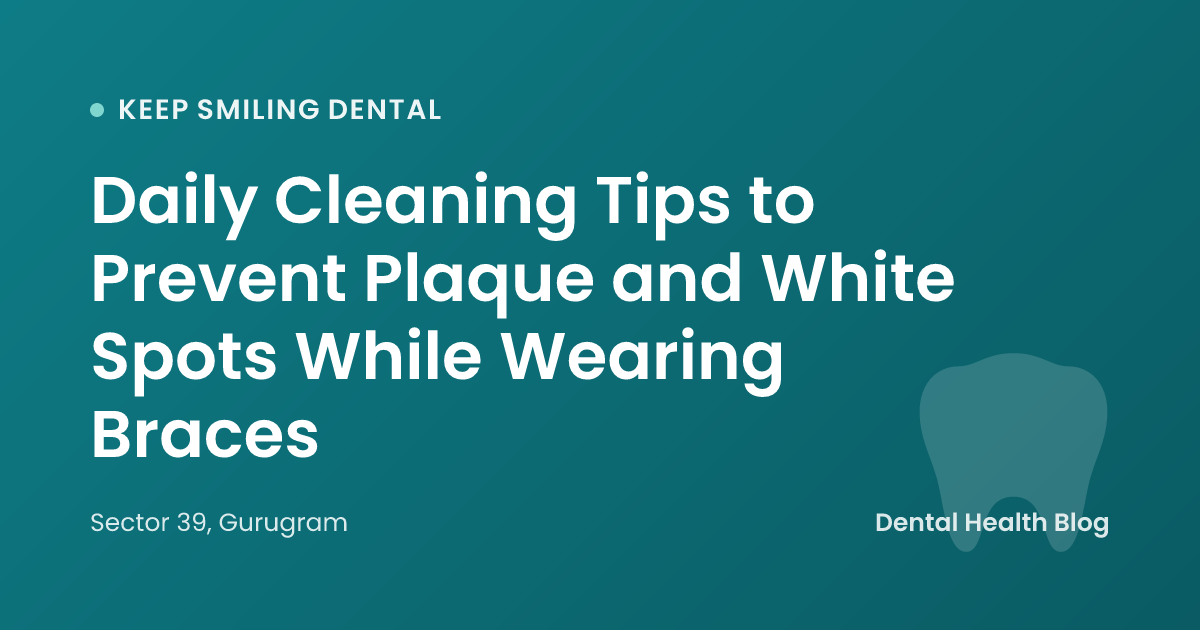 Daily Cleaning Tips to Prevent Plaque and White Spots While Wearing Braces