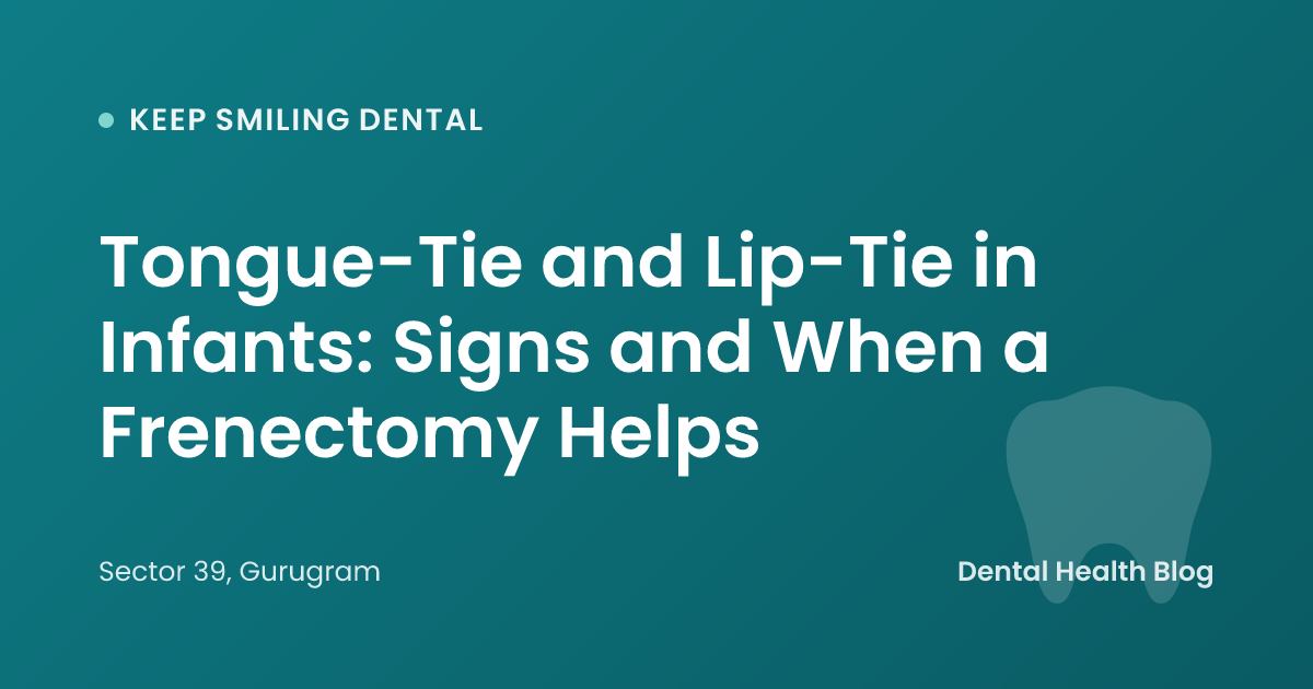 Tongue-Tie and Lip-Tie in Infants: Signs and When a Frenectomy Helps