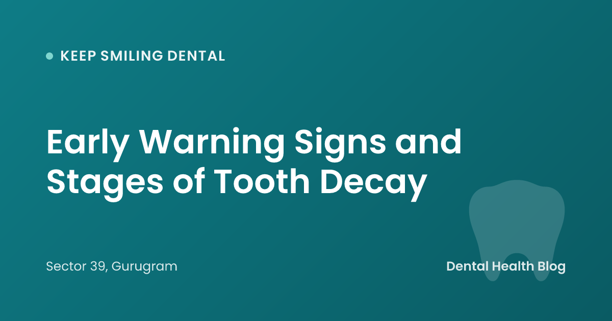 Early Warning Signs and Stages of Tooth Decay