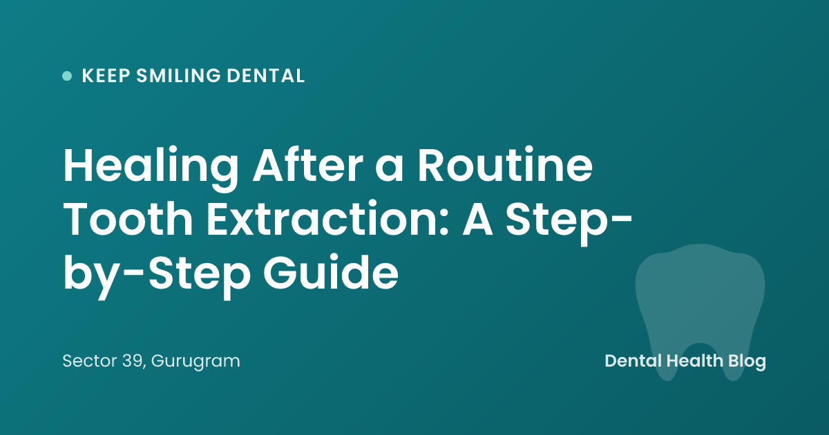 Healing After a Routine Tooth Extraction: A Step-by-Step Guide